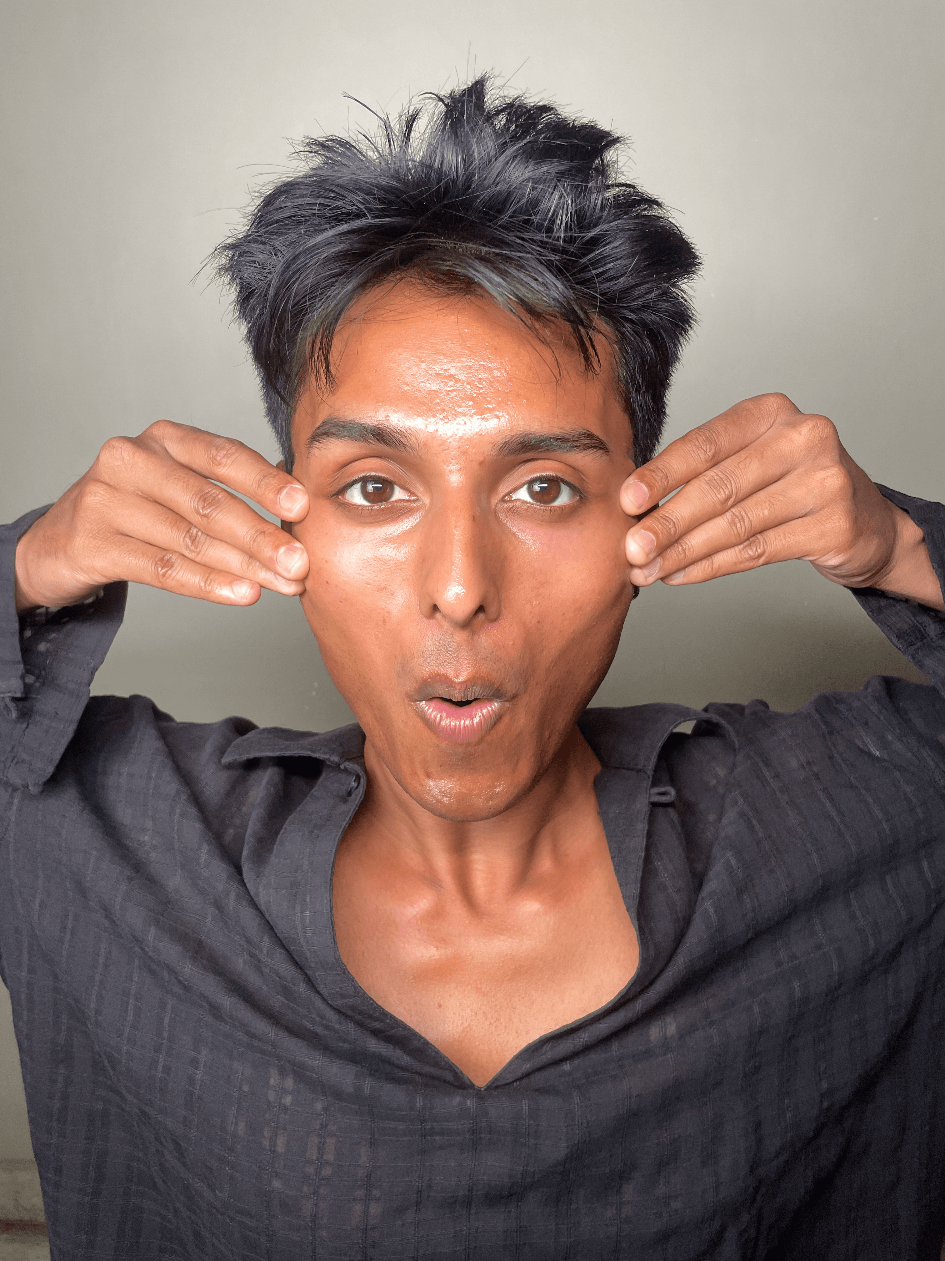 Facial muscle lifting: pinch and lift technique for cheek volume